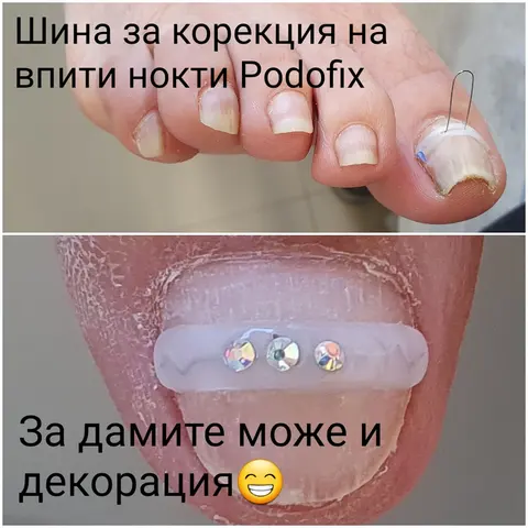 a2a87ce6-13bc-47d4-b452-2092ced972b0_4ovp