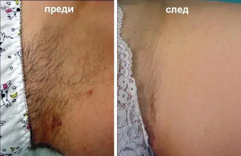 ЛАЗЕР ЦЕНТЪР Be Sexy — снимка 1 от сайта на фирмата