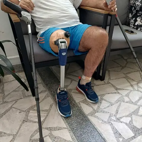 МТЛ ХАБИТУС ПРОТЕЗИ И ОРТЕЗИ — снимка 3 от сайта на фирмата